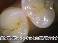 治療例 219 - 審美歯科