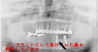 治療後の状態